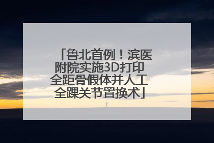 鲁北首例！滨医附院实施3D打印全距骨假体并人工全踝关节置换术